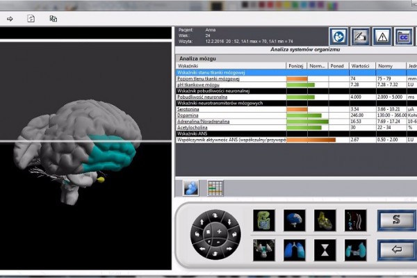 Analiza mózgu